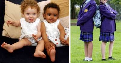 100萬分之1「黑白雙胞胎」長大了！ 11歲「一個像公主一個像男孩」媽媽苦笑：完全沒人信